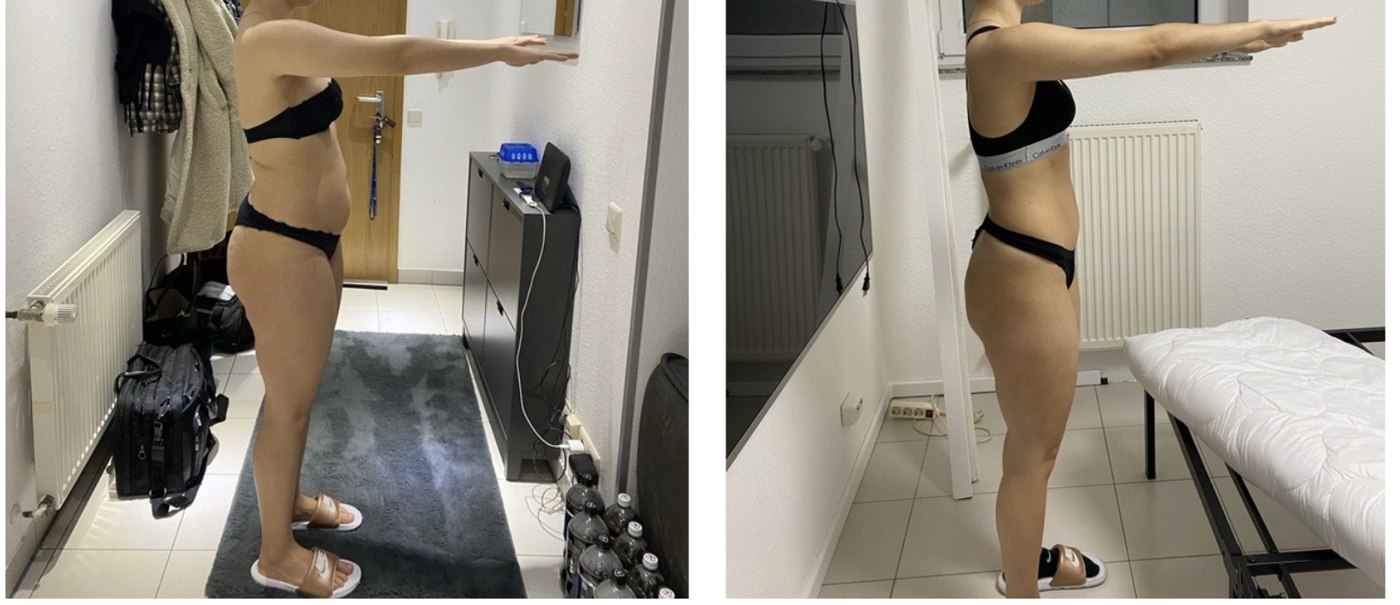 Vorher-Nachher: minus 5 kg in 4 Monaten